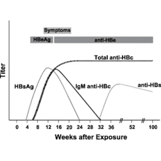 Hepatitis B Core IgM and Total